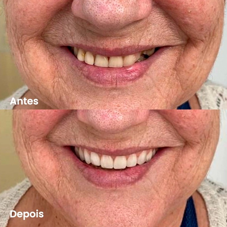 Antes e depois — caso real 3